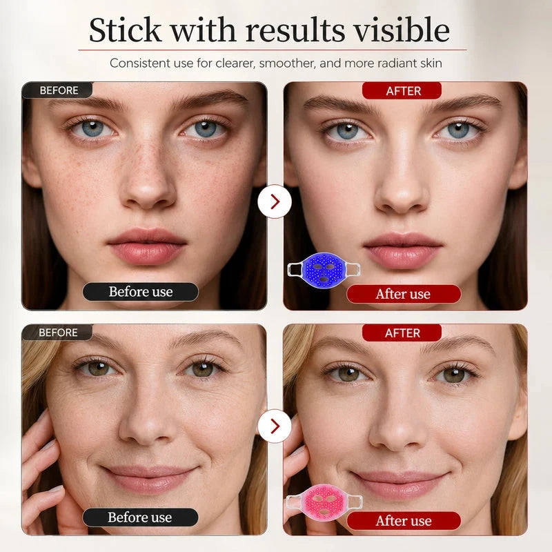 LED Light Therapy Face Mask